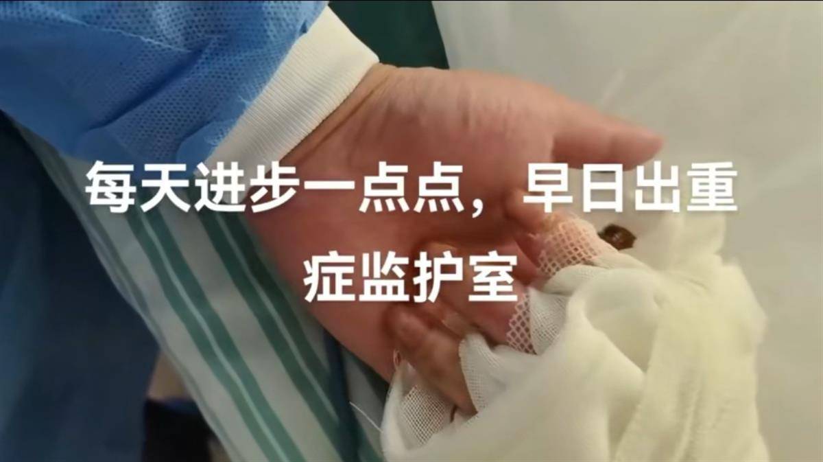 “烧伤妈妈”术后首次开口说话，称一辈子的苦都吃完了，其丈夫已开始带货，512件好物有497人跟买