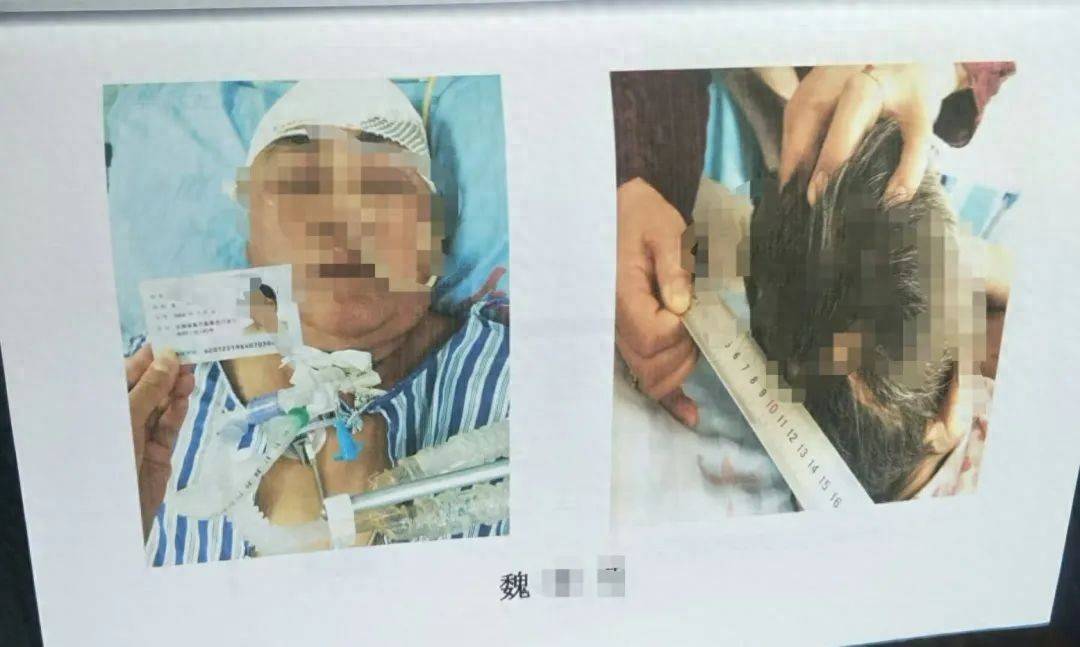 目睹母亲过马路被车撞,27岁女子受惊吓5天后身亡