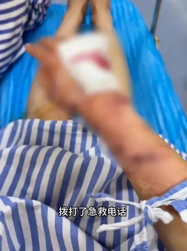 洗澡时突然爆炸，女子手筋断裂，多处缝针……家里有它快自查