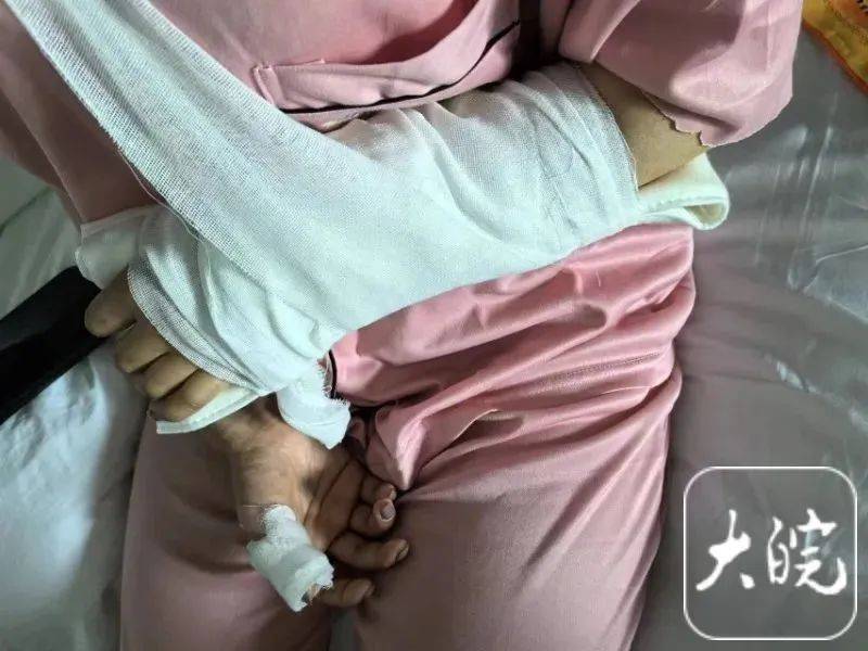 洗澡时突然爆炸，女子手筋断裂，多处缝针……家里有它快自查