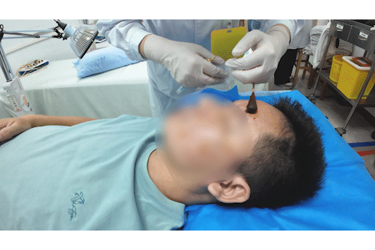 醒来“天塌了”!深圳一女子眼睛闭不上、嘴巴漏水!这些错误很多人会犯