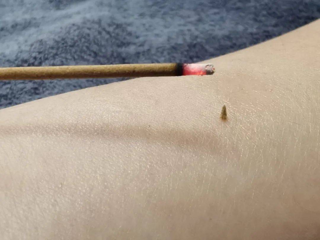 醒来“天塌了”!深圳一女子眼睛闭不上、嘴巴漏水!这些错误很多人会犯