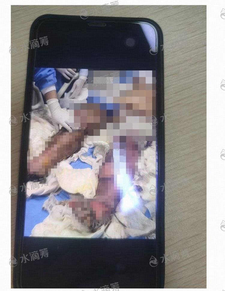 成都一小区电瓶车楼道“飞线充电”酿火灾，一家四口1死2伤，涉事车主被刑拘