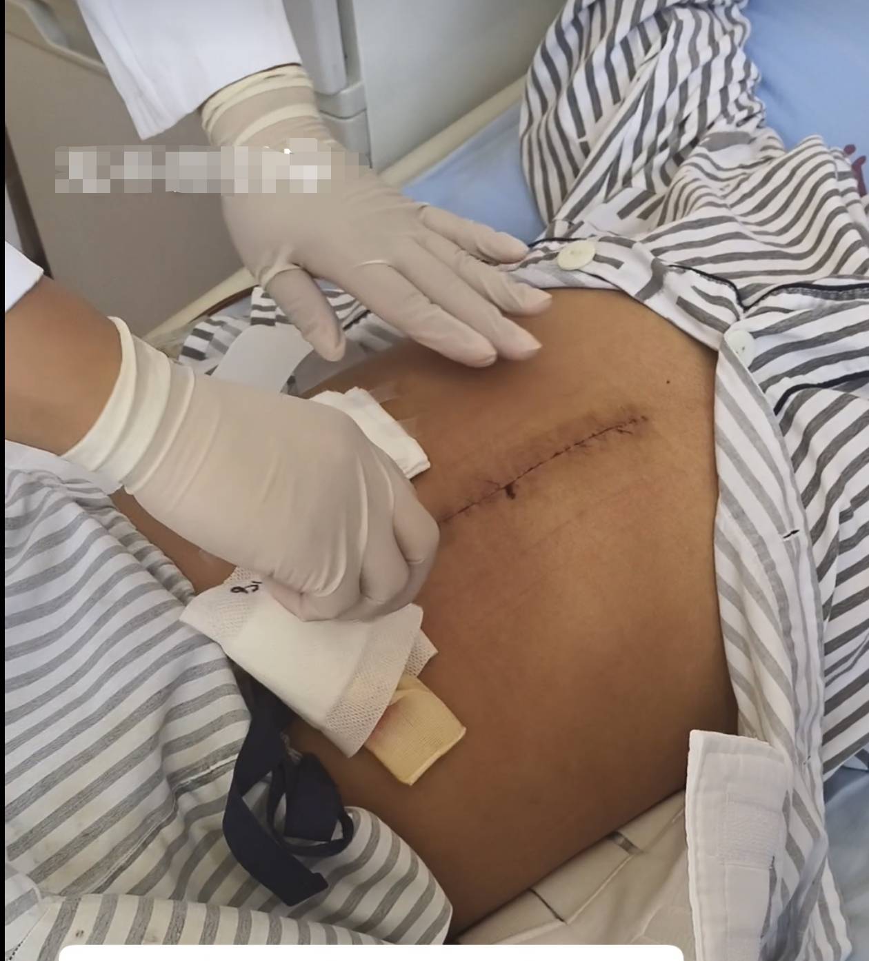 奶奶在哭，宝宝在笑！40天女婴重病，00后父亲割肝救女，术后这一幕让网友泪奔