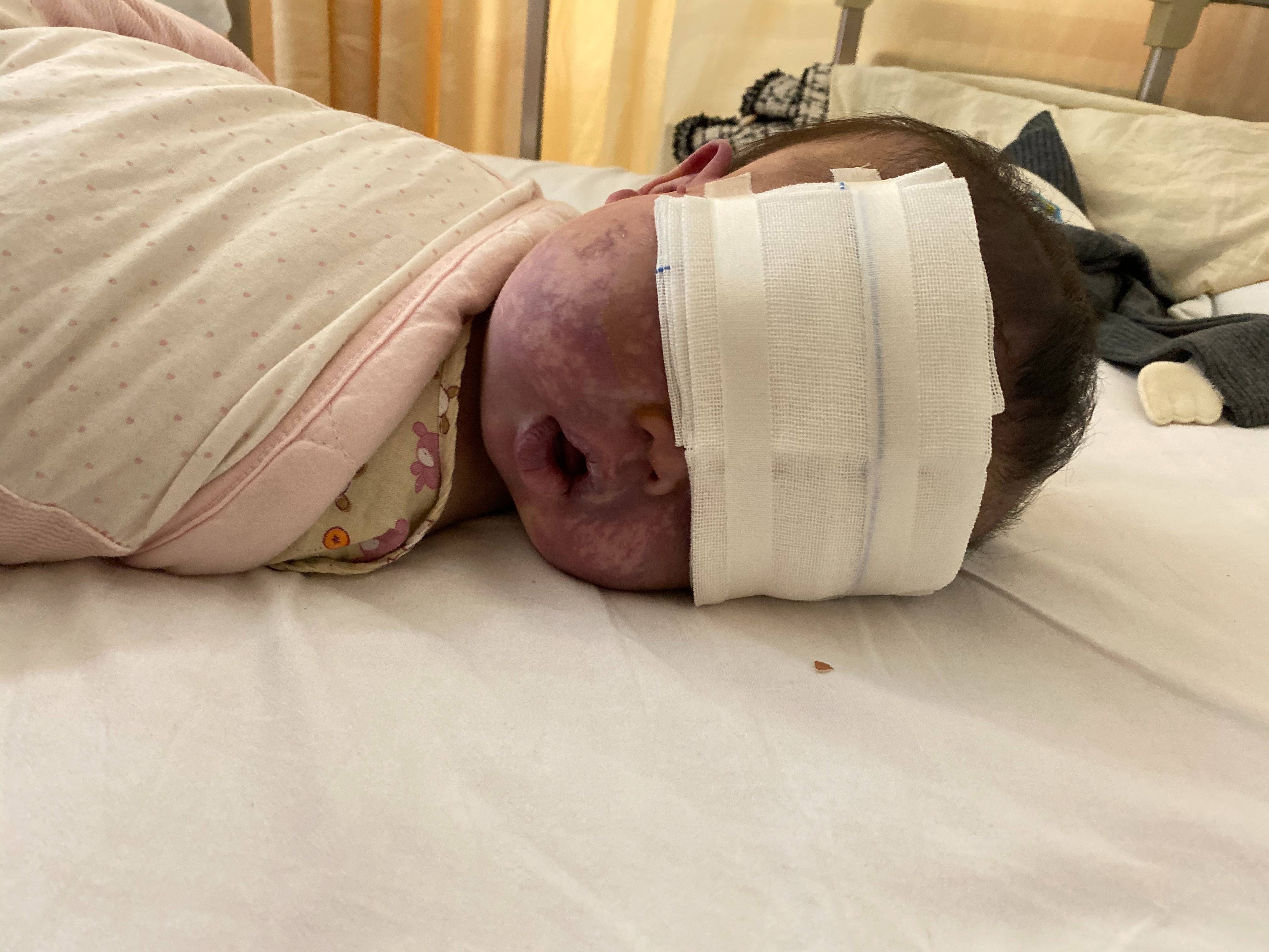 上饶6岁女童患病满身红斑，初上幼儿园妈妈字里行间满是担心：曾经绝望，现在能看到光