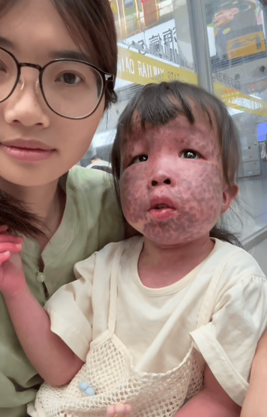 上饶6岁女童患病满身红斑，初上幼儿园妈妈字里行间满是担心：曾经绝望，现在能看到光